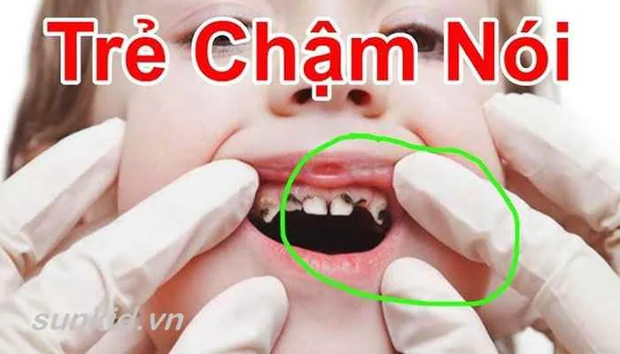 Làm thế nào để trẻ nhanh biết nói 5 Làm thế nào để trẻ nhanh biết nói, học cách làm thế nào để trẻ nhanh biết nói